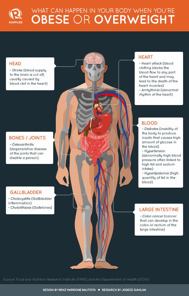 How Being Overweight Can Threaten Your Health 