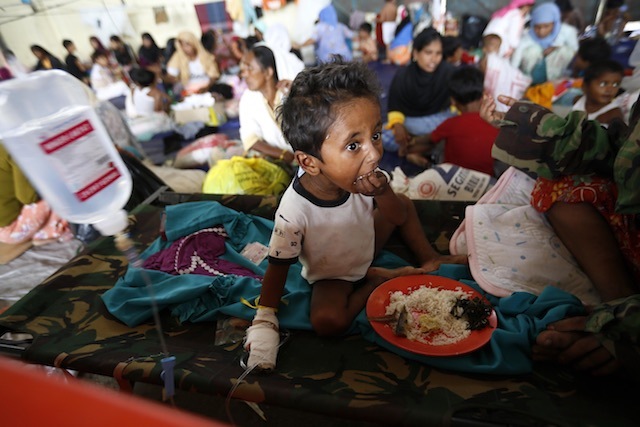 Seorang anak Rohingya sedang sarapan sekaligus diberi pengobatan medis di sebuah tempat pengungsian di Kuala Langsa, Aceh, Indonesia, pada 17 Mei 2015. Foto oleh Hotli Simanjuntak/EPA 