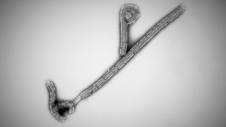THE GOOD COUSIN. Electron micrograph of Ebola Reston virus taken at the US Army Medical Research Institute of Infectious Diseases (USAMRIID) by Dr. Tom Geisbert. It was graciously supplied by Dr. Art Anderson. File photo from Stanford University.