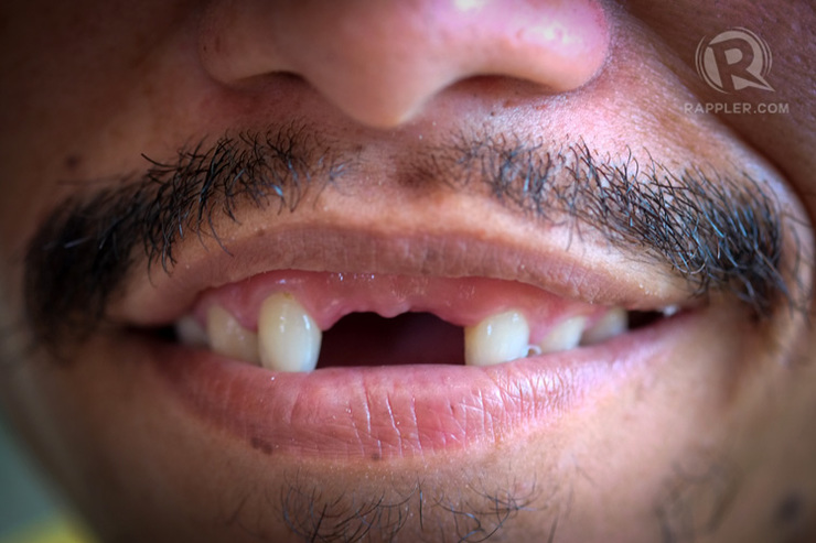 false-teeth-maker-daet-003a_82F8954910604C5E88E1ACBB6BAEE8D3.jpg