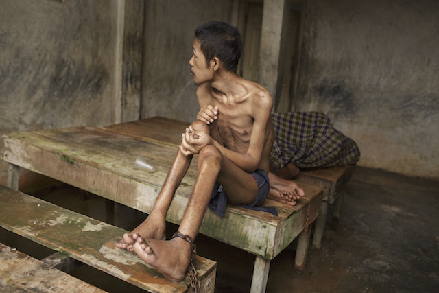 DEATH. Before he died, this mentally ill man lived chained to a platform at Kyai Syamsul's traditional healing center in Brebes, Central Java. While there his ankles swelled and his body became emaciated. Photo from Human Rights Watch      