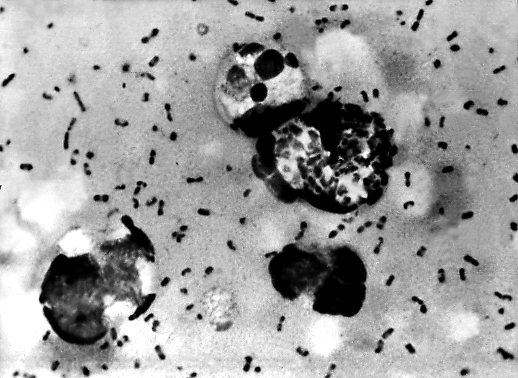 BUBONIC PLAGUE. This Centers For Disease Control (CDC) file image obtained 15 January, 2003, shows bubonic plague bacteria taken from a patient. Photo from AFP 