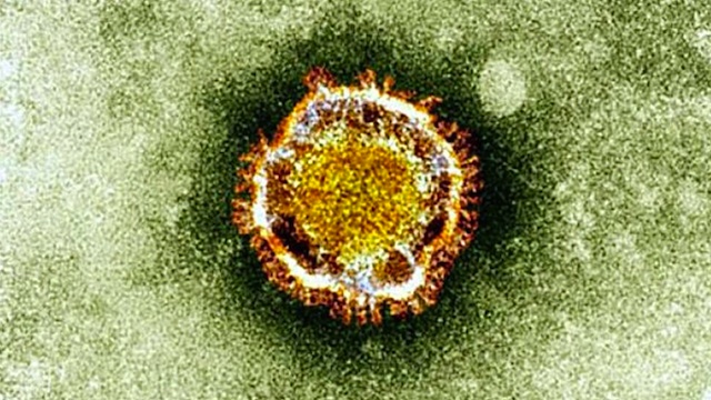 MERS. This undated handout picture courtesy of the British Health Protection Agency shows the Coronavirus seen under an electron microscope. AFP PHOTO / British Health Protection Agency