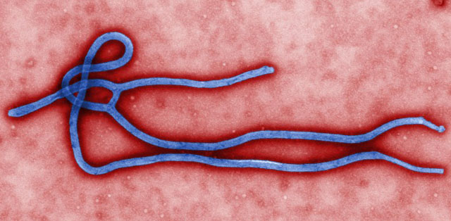 DEADLY VIRUS. This colorized transmission electron micrograph (TEM) obtained March 24, 2014 from the Centers for Disease Control (CDC) in Atlanta, Georgia, reveals some of the ultrastructural morphology displayed by an Ebola virus virion. Photo by Cynthia Goldsmith/CDC/AFP