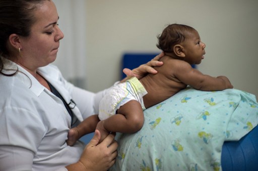 ZIKA VIRUS. This file photo taken on January 28, 2016 shows physical therapist Isana Santana treating a baby suffering from microcephalia caught through an Aedes Aegypti mosquito bite, at Obras Socias irma dulce hospital in Salvador, Brazil on January 28 , 2016. File photo by Christophe Simon/AFP   