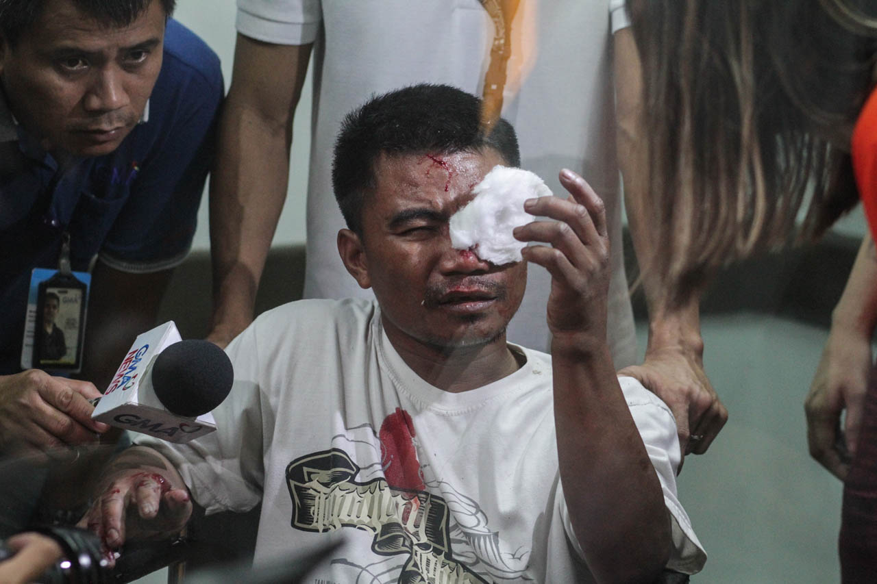 A man receives treatment in Jose Reyes Memorial Hospital, Manila