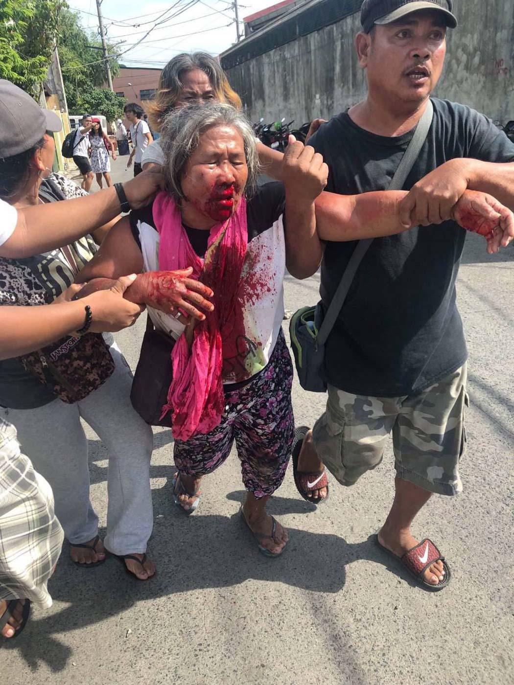 HURT. Violent dispersal of Nutriasia protesters on July 30, 2018. Photo from Anakbayan  
