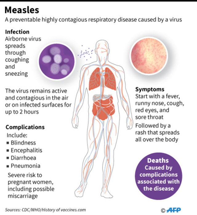 Getting measles wipes out immune protection for other diseases