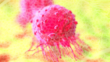 Cancer Gene Twice As Likely To Be >> Breast Cancer Gene Does Not Boost Risk Of Death Study Cancer Gene Twice As Likely To Be >> Breast Cancer Gene Does Not Boost Risk Of Death Study