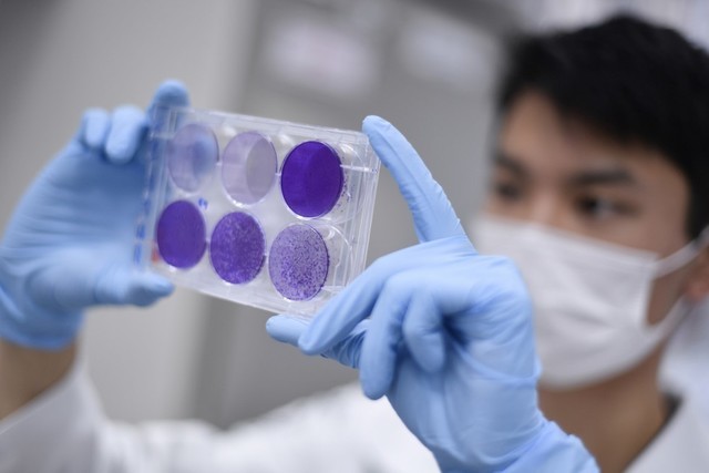 POSSIBLE CURE? A researcher works on virus replication to develop a vaccine against the coronavirus COVID-19, in Belo Horizonte, Minas Gerais state, Brazil, on March 26, 2020. Photo by Douglas Magno / AFP 